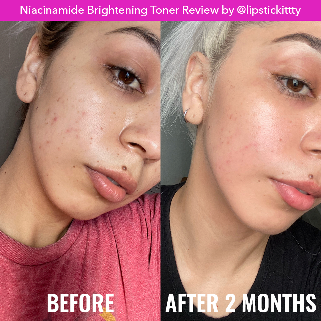 Good molecules niacinamide brightening toner 120ml ivy s store